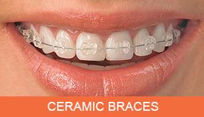 Ceramic-braces