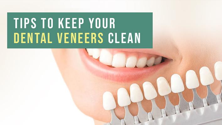 caring for your veneers