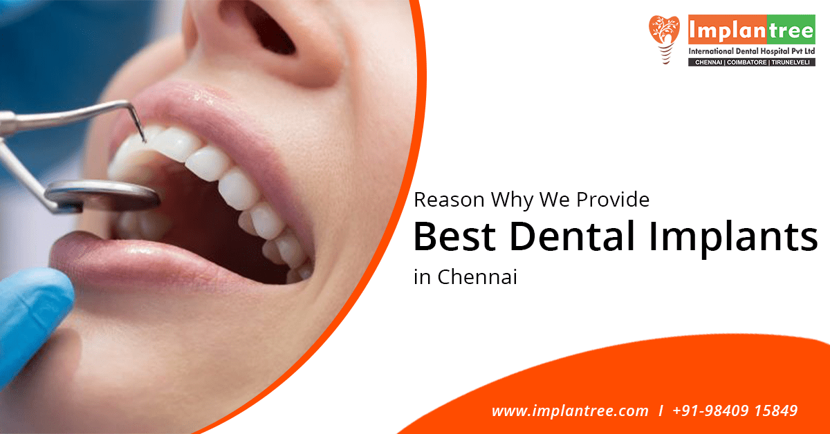 Best Dental Implant Clinic in Chennai